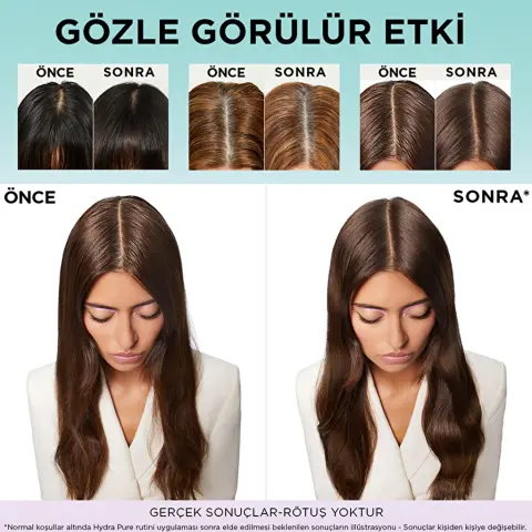 Elseve Hydra Hyaluronic Pure Yağlanma Karşıtı Arındırıcı Şampuan 300 mL